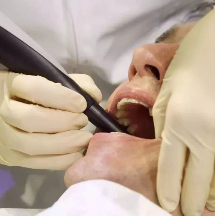 患口腔溃疡三周后被确诊为舌癌！医生：牙齿出现这些情况要注意！