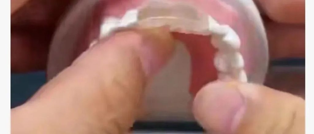 专业牙医警告：请远离某多多和某音上的这些坑牙产品！