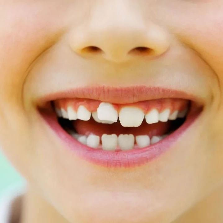 孩子护牙重点，0~12岁，建议妈妈收藏！